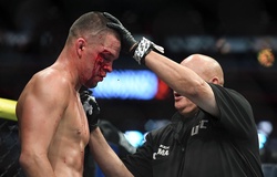 Bác sĩ tại UFC 244 nhận nhiều tin nhắn đe dọa vì dừng trận Diaz vs. Masvidal