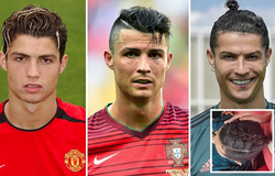 Ronaldo trải qua bao nhiêu kiểu tóc trong sự nghiệp? 