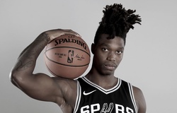 Cầu thủ San Antonio Spurs tiết lộ sự thật đau lòng sau mái tóc kỳ dị