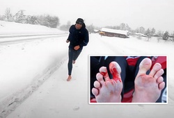 Chân tóe máu vì cố phá kỷ lục thế giới chạy 21km chân trần trên tuyết