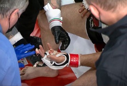 Chấn thương kinh hoàng: Võ sĩ MMA... rơi ngón tay giữa trận đấu