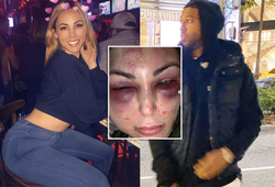 Rò rỉ video cựu cầu thủ Lakers hành hung dã man bạn gái nóng bỏng