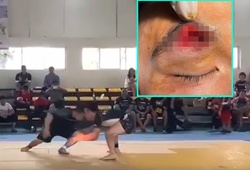 Tai nạn húc đầu tại giải Jujitsu toàn quốc, võ sĩ phải khâu 30 mũi