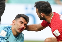 Hình ảnh chấn thương đáng sợ của thủ môn Iran trước khi bị vùi dập