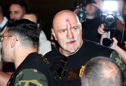 Bố Tyson Fury xô xát với Team Oleksandr Usyk tới chảy máu đầu