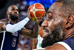 LeBron James rách mí mắt, khâu 4 mũi trước thềm 2 trận cuối cùng tuyển Mỹ tại Olympic 2024