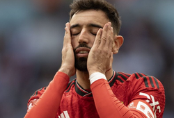 Tỷ lệ kèo trận MU vs Burnley, 21h ngày 30/8, Ngoại hạng Anh