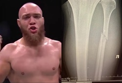 "Lấy chân đổi chân": Võ sĩ UFC lập kỷ lục 4 đòn "xoắn gót" liên tiếp 