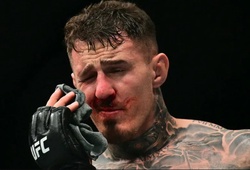 Tom Aspinall phải phẫu thuật hai mắt sau sự cố chọc mắt tại UFC 321