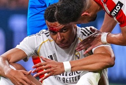 Mbappe đổ máu sau pha phạm lỗi dẫn đến quả phạt đền không được thổi phạt