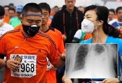 Chàng trai suýt hỏng phổi vì chạy đeo khẩu trang: Bác sĩ đưa ra lời khuyên