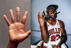 Michael Jordan đã suýt tự cắt đứt lìa ngón tay của mình như thế nào?