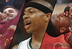 Những pha va chạm khiến sao NBA... mất răng