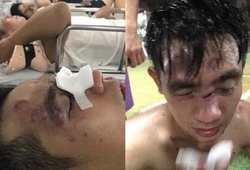 Thắng đậm đối thủ bắt qua mạng, đội bóng sinh viên bị đánh đến nhập viện