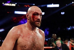 Tyson Fury khâu 50 mũi sau trận đấu với Otto Wallin