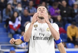 Bale lại chấn thương và top 5 thống kê không thể bỏ qua trận Alaves - Real Madrid