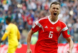 Người hùng của đội tuyển Nga tại World Cup 2018 bị điều tra sử dụng doping