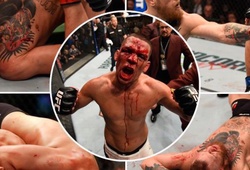 Nate Diaz thiết lập một loạt kỷ lục sau UFC 202