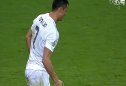 Ronaldo nhăn nhó vì chấn thương gân kheo