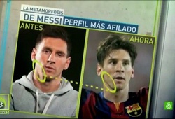 Trước thềm đại chiến, Messi đi phẫu thuật… gọt cằm