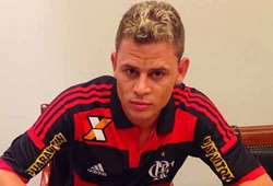 Pha va chạm kinh hoàng khiến cầu thủ Flamengo gãy gập tay