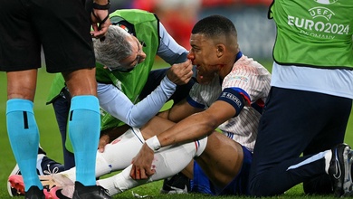 Cận cảnh chấn thương mũi của Mbappe khiến tuyển Pháp lo ngại