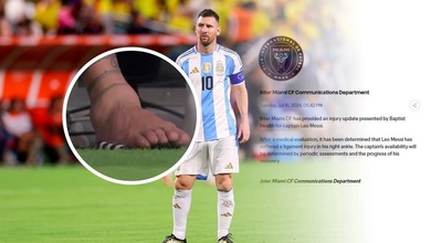 Messi dính chấn thương dây chằng, Inter Miami thông báo thời gian vắng mặt