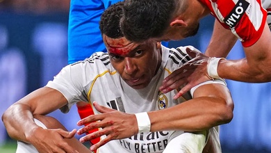 Mbappe đổ máu sau pha phạm lỗi dẫn đến quả phạt đền không được thổi phạt