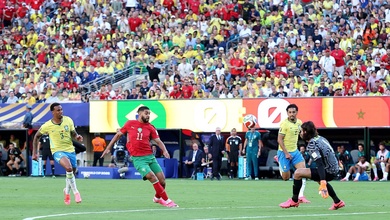 Brazil đối mặt 2 vấn đề đáng lo ngại trong màn ra mắt World Cup đáng thất vọng