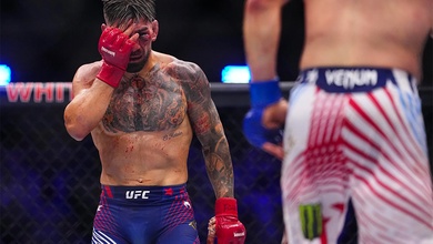 Chấn thương khủng khiếp của Ilia Topuria sau trận chiến tại UFC Nhà Trắng