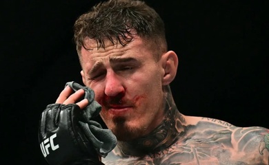 Tom Aspinall phải phẫu thuật hai mắt sau sự cố chọc mắt tại UFC 321