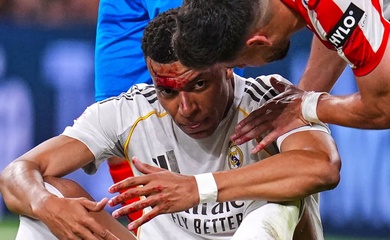 Mbappe đổ máu sau pha phạm lỗi dẫn đến quả phạt đền không được thổi phạt