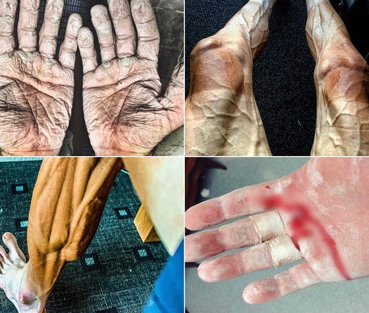 Các VĐV Olympic đã chịu áp lực lớn thế nào lên cơ thể khi thi đấu?