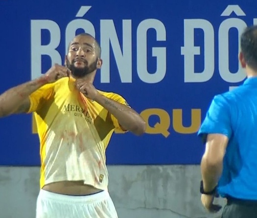 Máu đổ, trận đấu vụn vỡ và 5 bàn thắng quá kịch tính ở trận Bình Định vs Thanh Hóa