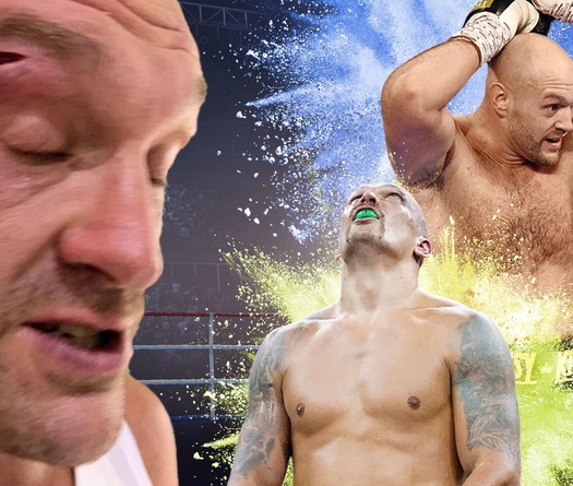 NÓNG: Tyson Fury rách mắt, dời lịch trận so găng Oleksandr Usyk