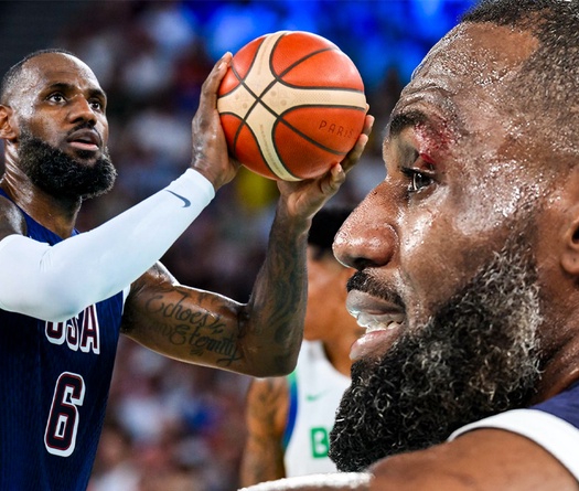 LeBron James rách mí mắt, khâu 4 mũi trước thềm 2 trận cuối cùng tuyển Mỹ tại Olympic 2024