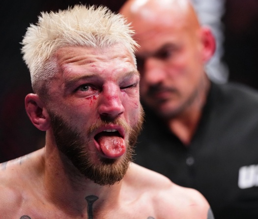 Ba võ sĩ phải nhập viện sau sự kiện UFC Qatar khốc liệt