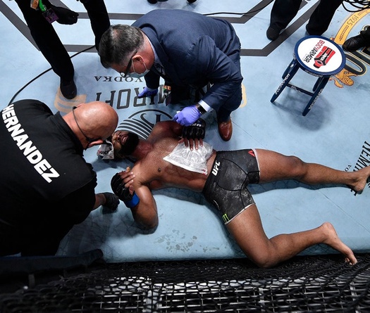 Kinh hoàng Ảnh chụp chiếc sườn gãy của cựu vương UFC Tyron Woodley