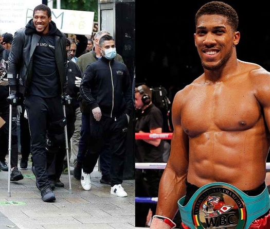 Anthony Joshua cũng chống nạng đi biểu tình