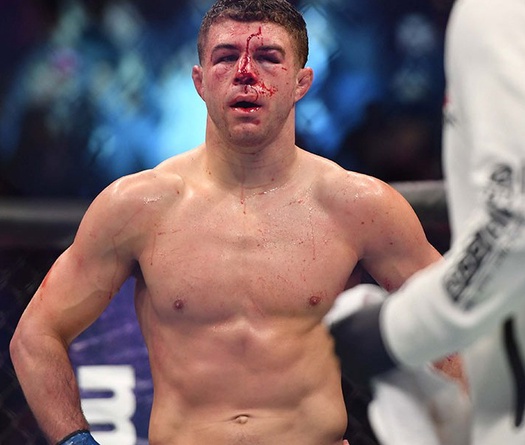 Dustin Poirier, Al Iaquinta đòi cắt hợp đồng Lightweight UFC