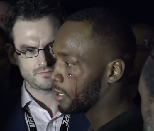 Gạ kèo, Leon Edwards bị Jorge Masvidal đấm rách mặt sau buổi họp báo UFC