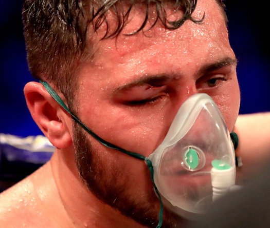 Bị đánh đến phải chụp ống thở, có phải do David Allen nhậu nhẹt xuyên đêm?