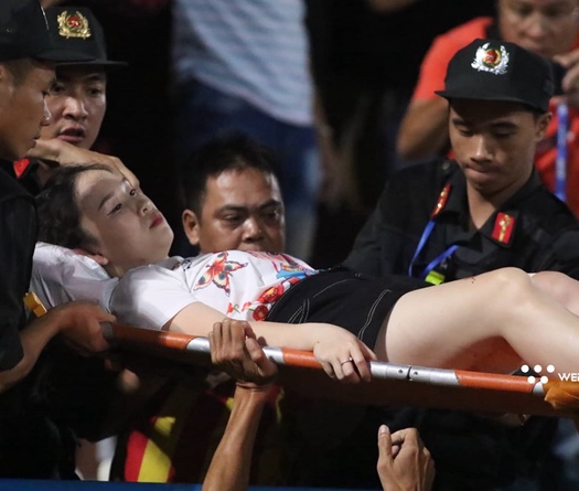CĐV nữ bị tai nạn, đổ máu vì pháo sáng tại Hàng Đẫy