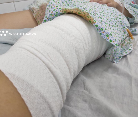 Nữ CĐV bị trúng pháo sáng được mổ thành công lần 1