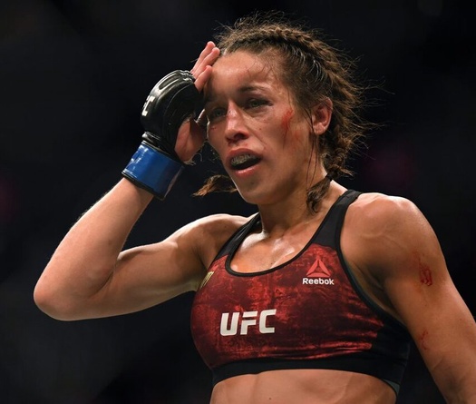 Chấn thương gây biến dạng của Joanna Jedrzejczyk