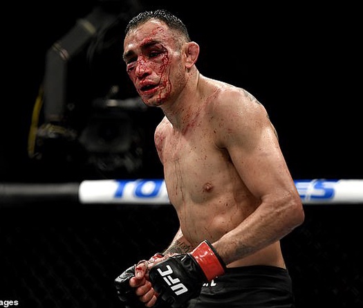 Tony Ferguson nhập viện sau trận kịch chiến với Justin Gaethje