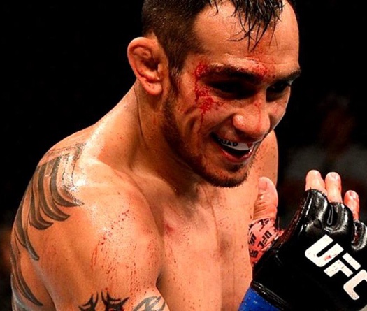 Nhiều khả năng Tony Ferguson là đối thủ kế tiếp của Khabib Nurmagomedov