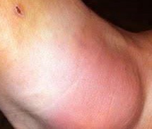 Độc đáo món thuốc bí chế của các võ sĩ Muay ở Thái Lan