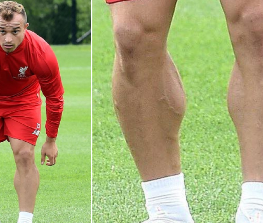 Shaqiri tiết lộ bí quyết để có bắp chân "khiếp" nhất làng túc cầu