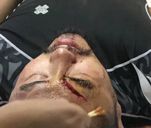 Từ Hiểu Đông thua "sấp mặt" khi đối đầu võ sĩ Muay Thái 